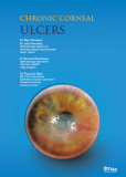 Chronic Corneal Ulcers